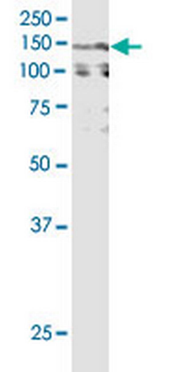 CACNA2D2 Antibody in Western Blot (WB)