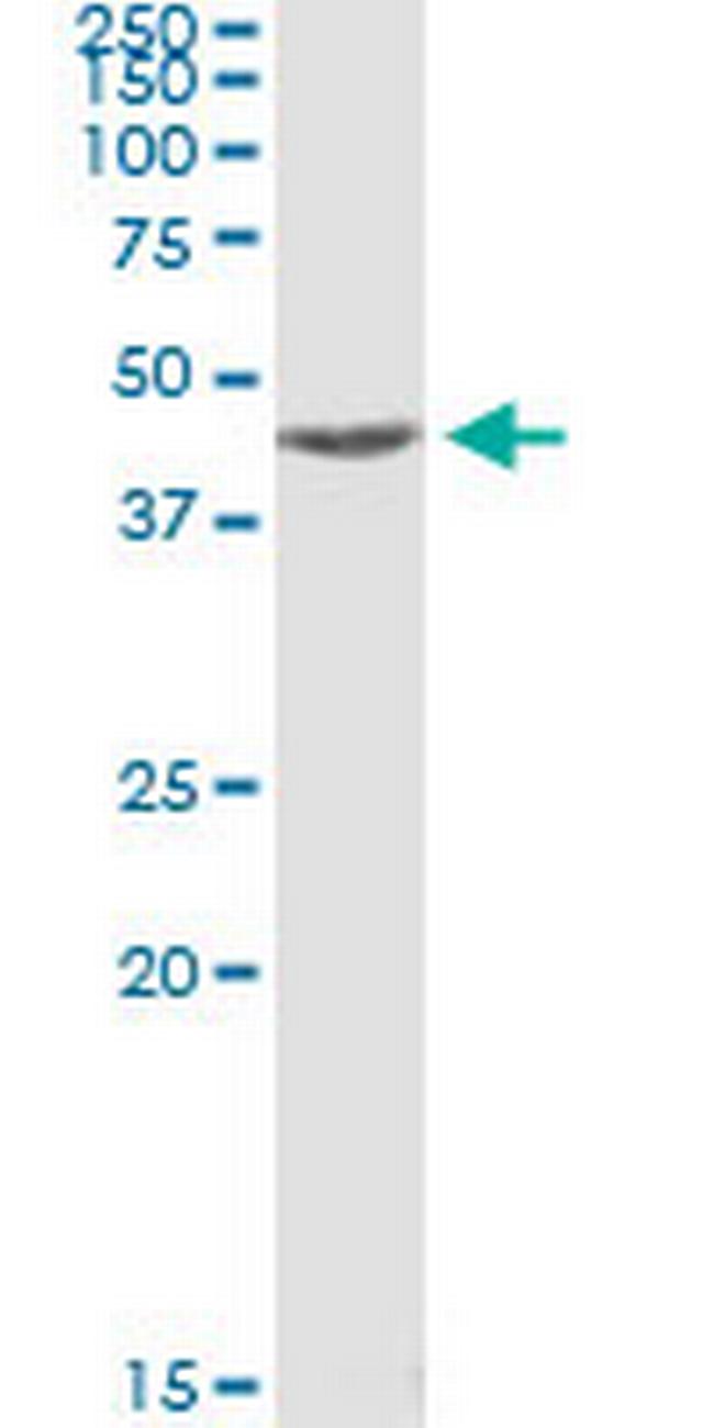 MAPKAPK2 Antibody in Immunoprecipitation (IP)