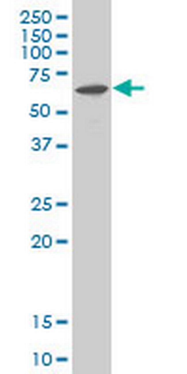 MAPKAPK2 Antibody in Western Blot (WB)