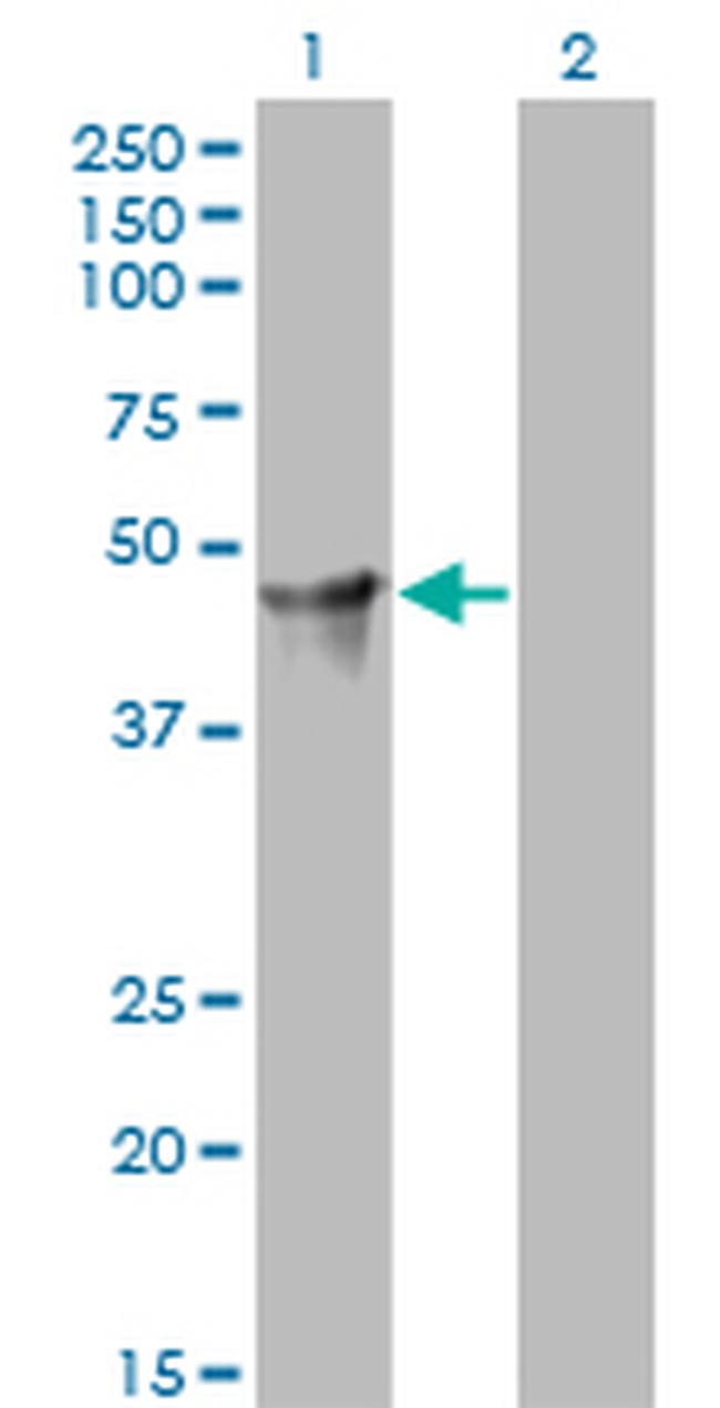 CYTH2 Antibody in Western Blot (WB)