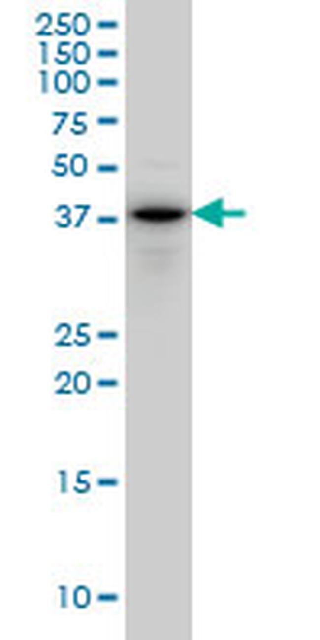 CYTH2 Antibody in Western Blot (WB)