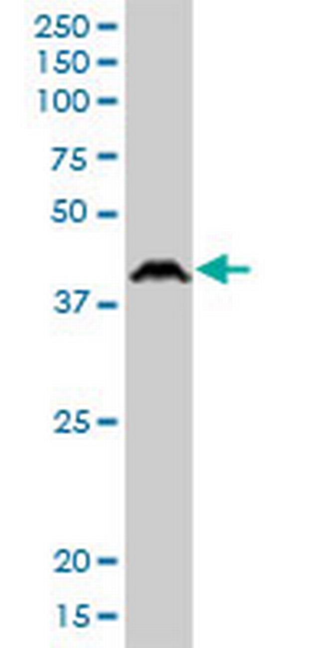 PSCD1 Antibody in Western Blot (WB)