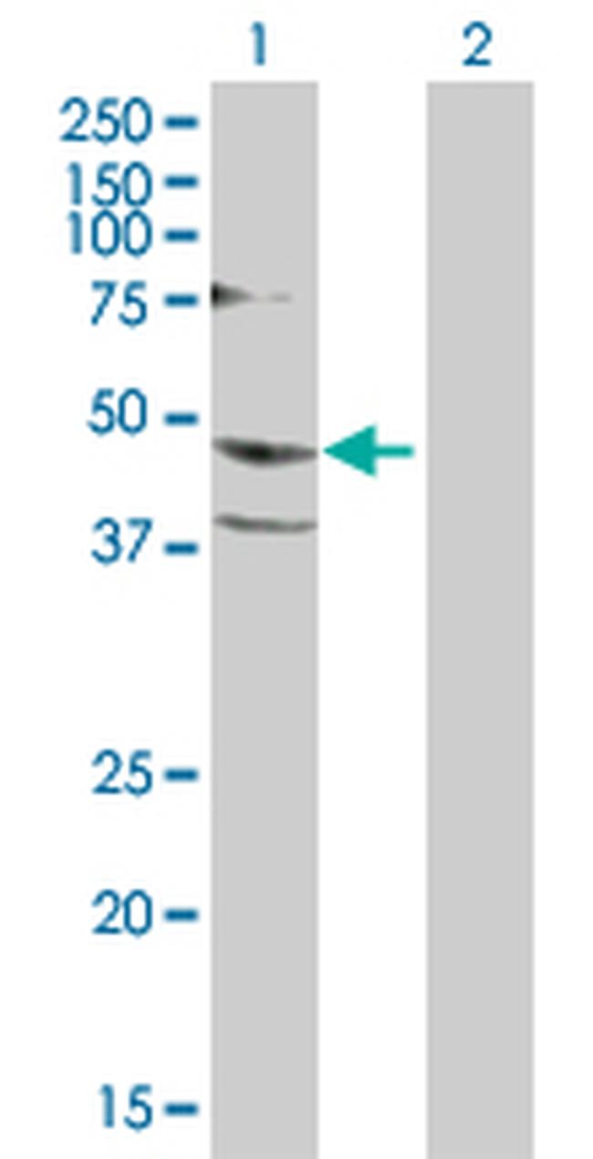 PSCD1 Antibody in Western Blot (WB)