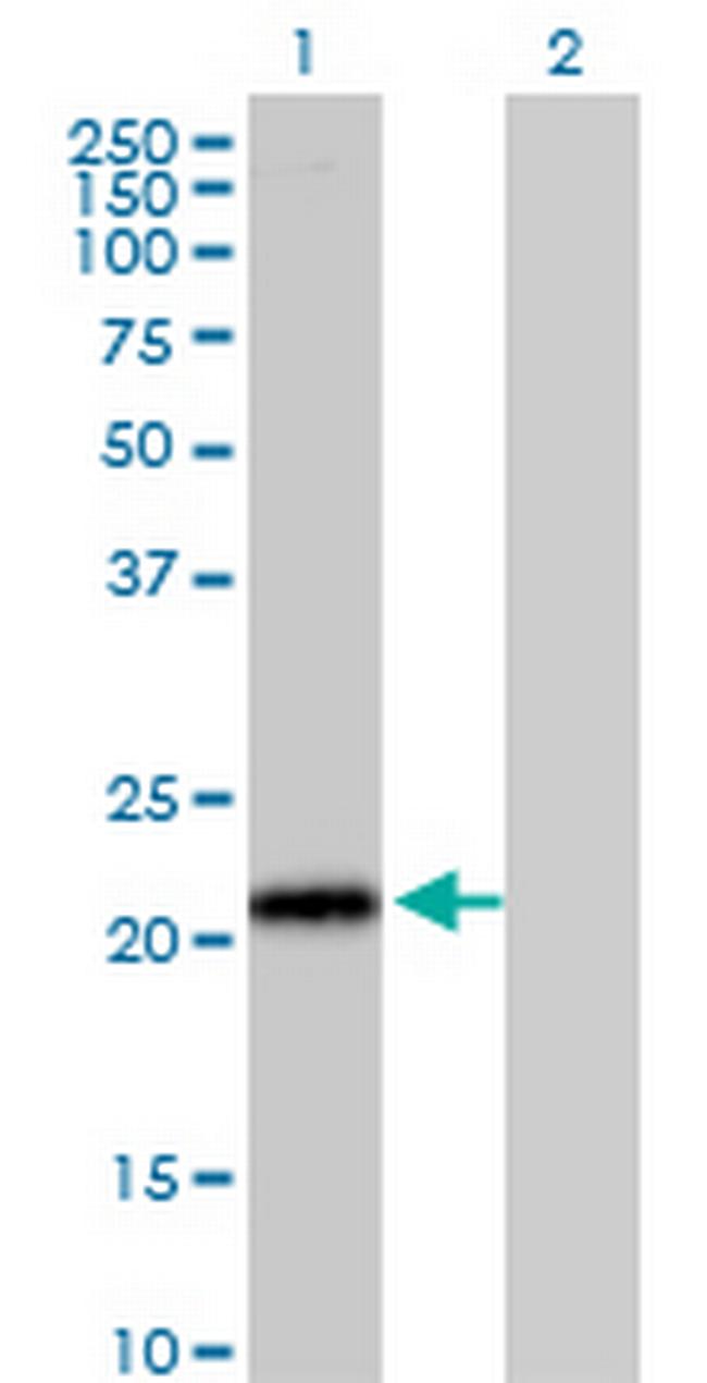 ITGB1BP1 Antibody in Western Blot (WB)