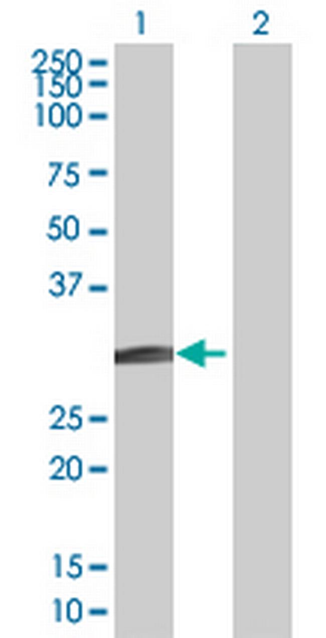 BCL7B Antibody in Western Blot (WB)