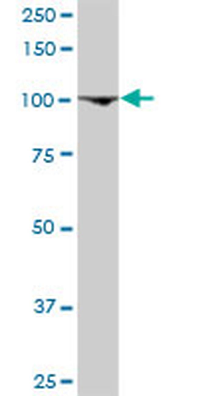 GTF3C3 Antibody in Western Blot (WB)