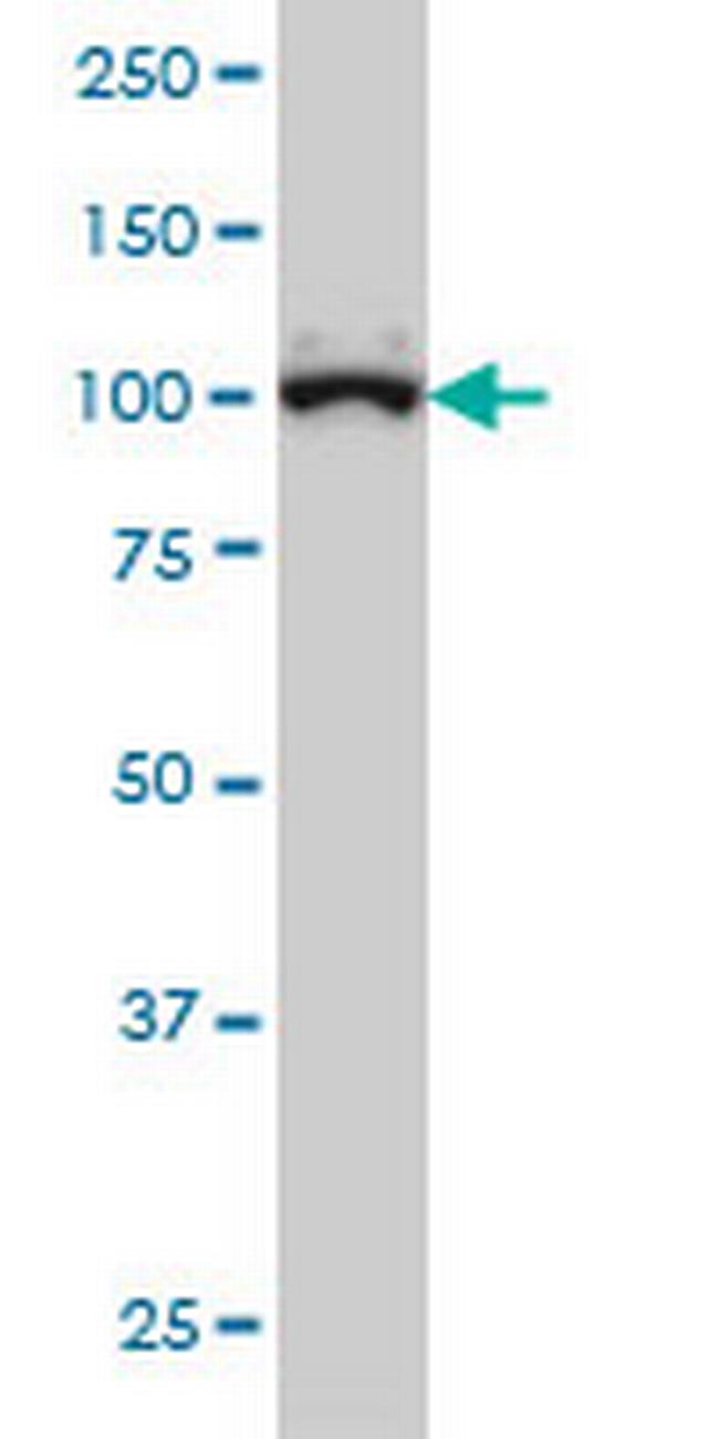 GTF3C3 Antibody in Western Blot (WB)