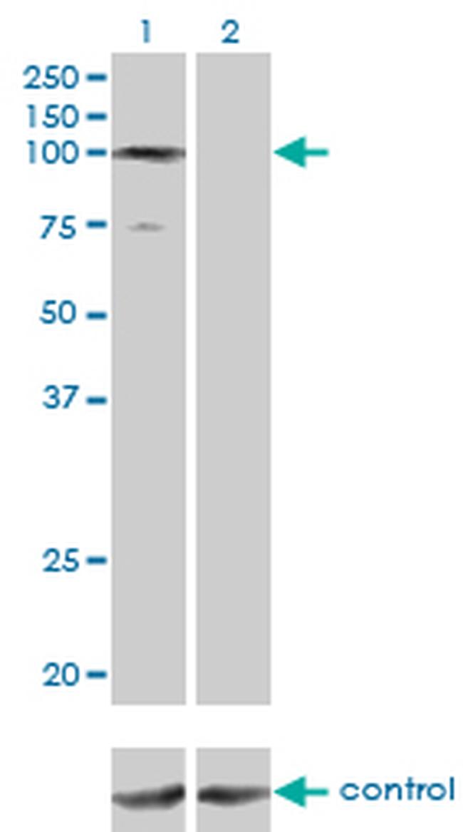 GTF3C3 Antibody in Western Blot (WB)