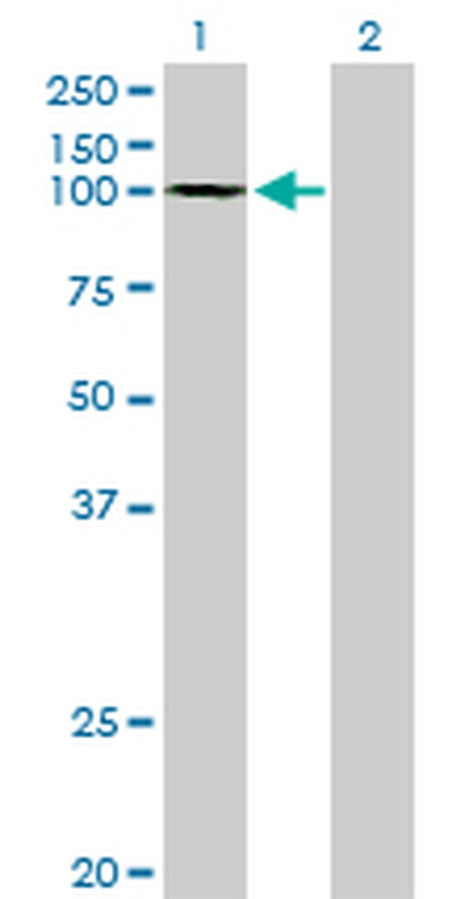 GTF3C3 Antibody in Western Blot (WB)