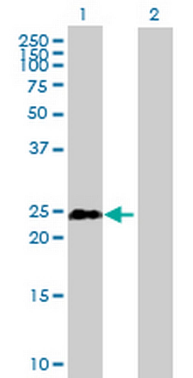 TCEAL1 Antibody in Western Blot (WB)