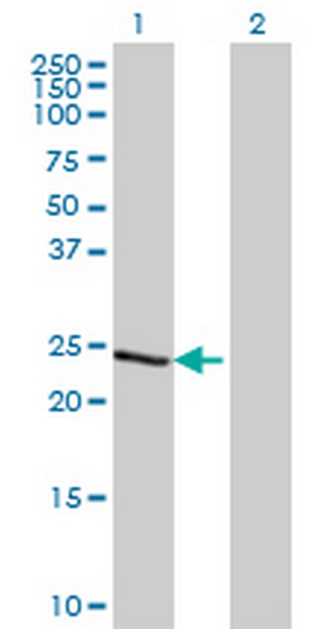 TCEAL1 Antibody in Western Blot (WB)