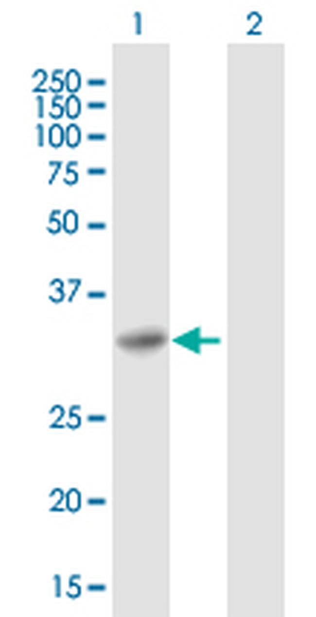 SNAP29 Antibody in Western Blot (WB)