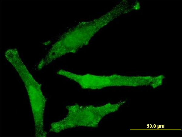 SNAP29 Antibody in Immunocytochemistry (ICC/IF)