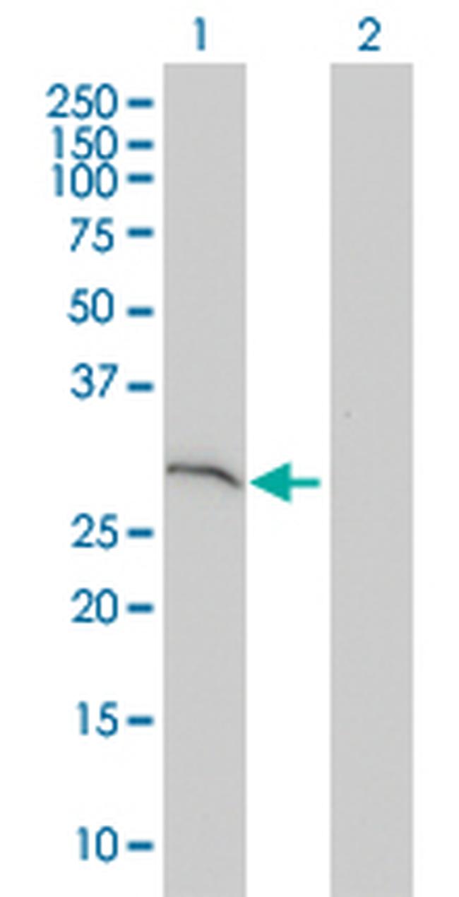 SNAP29 Antibody in Western Blot (WB)