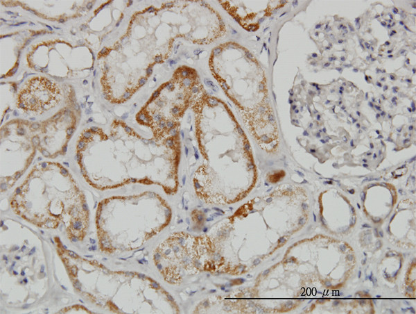 TAOK2 Antibody in Immunohistochemistry (Paraffin) (IHC (P))