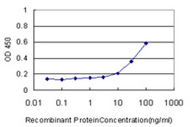 TAOK2 Antibody in ELISA (ELISA)