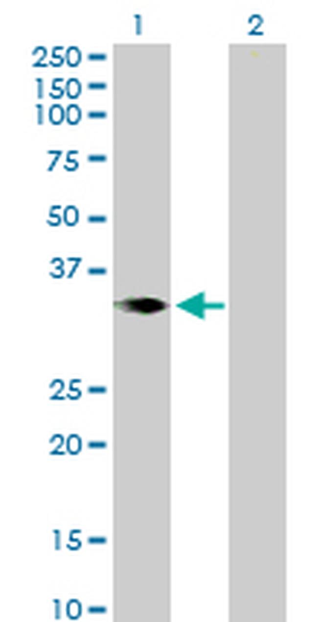 CER1 Antibody in Western Blot (WB)