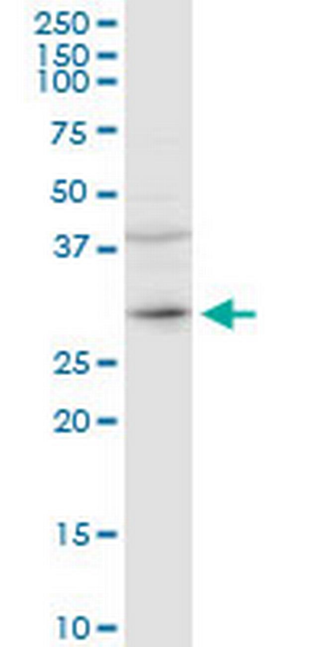 CER1 Antibody in Western Blot (WB)