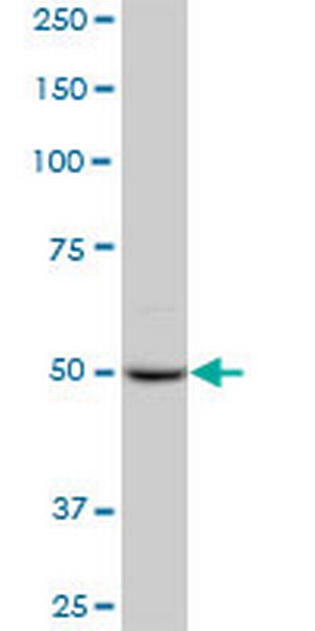 PPIG Antibody in Western Blot (WB)