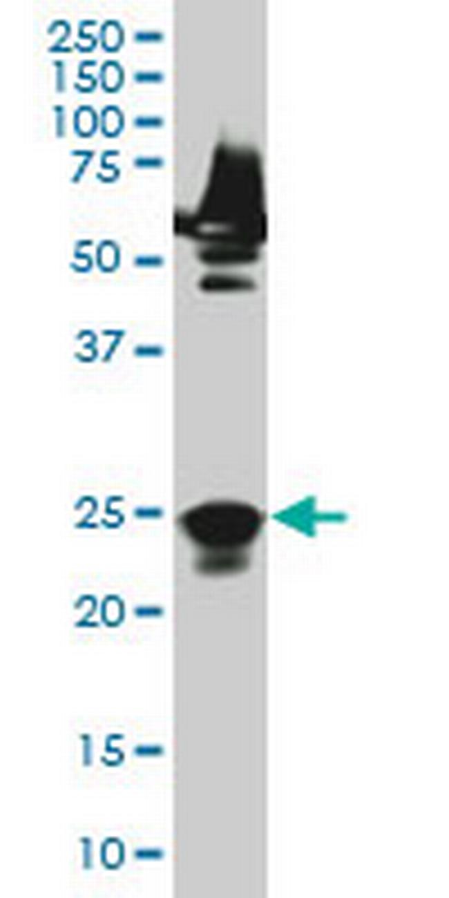 RAB33A Antibody in Western Blot (WB)