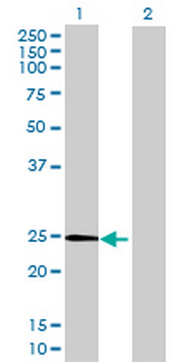 RAB9A Antibody in Western Blot (WB)