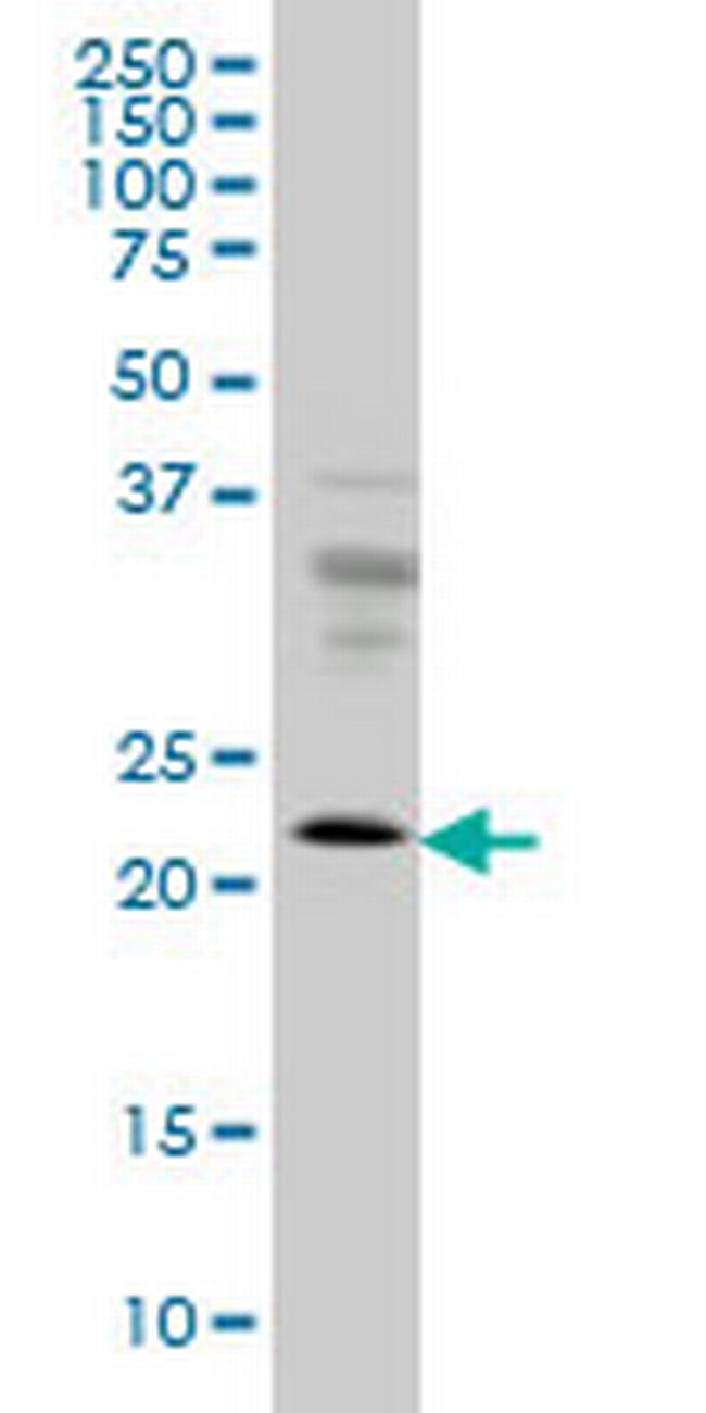 RAB9A Antibody in Western Blot (WB)