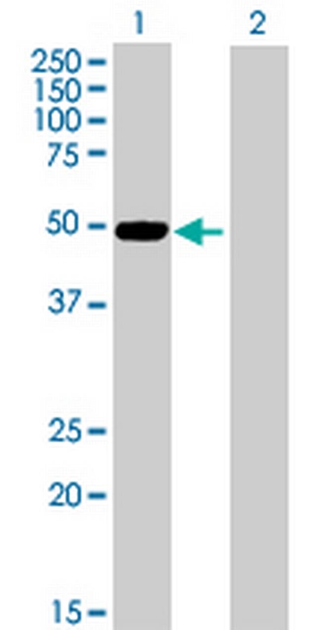 SLC9A3R1 Antibody in Western Blot (WB)