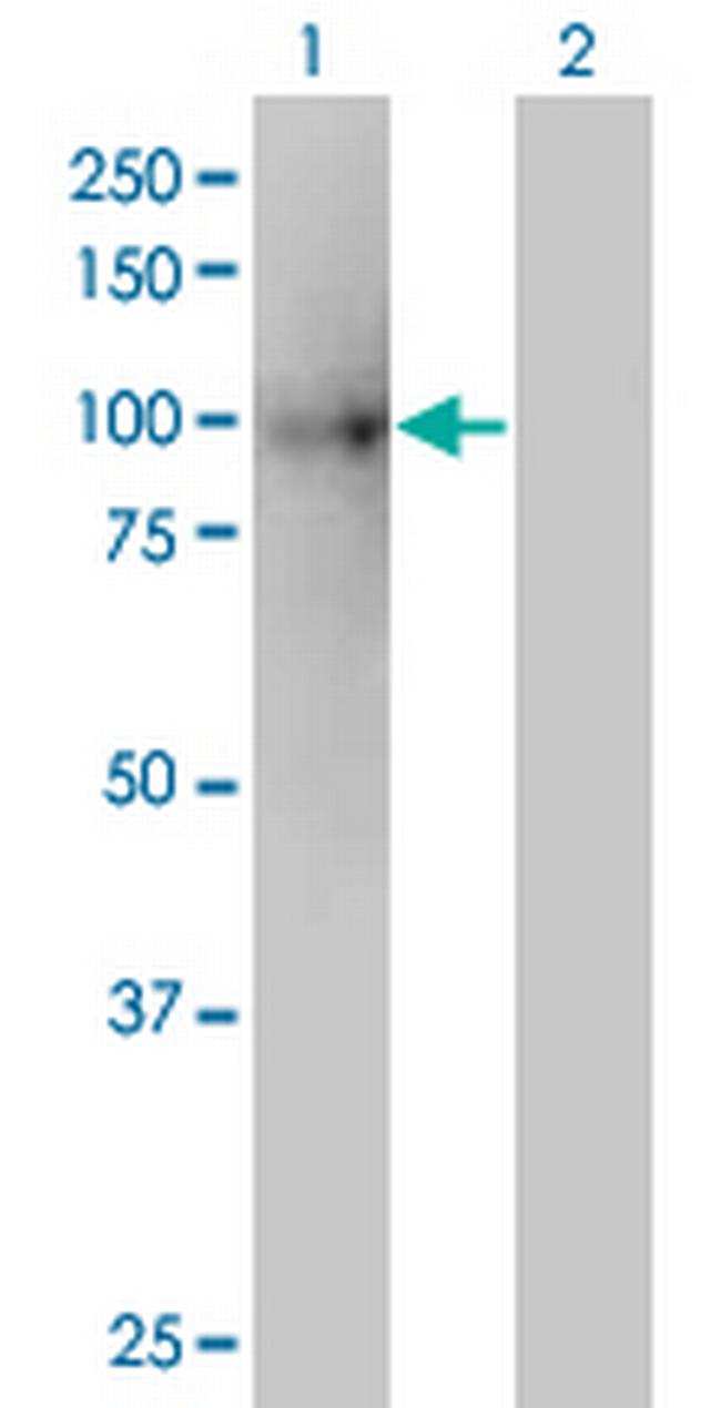 KIF3B Antibody in Western Blot (WB)