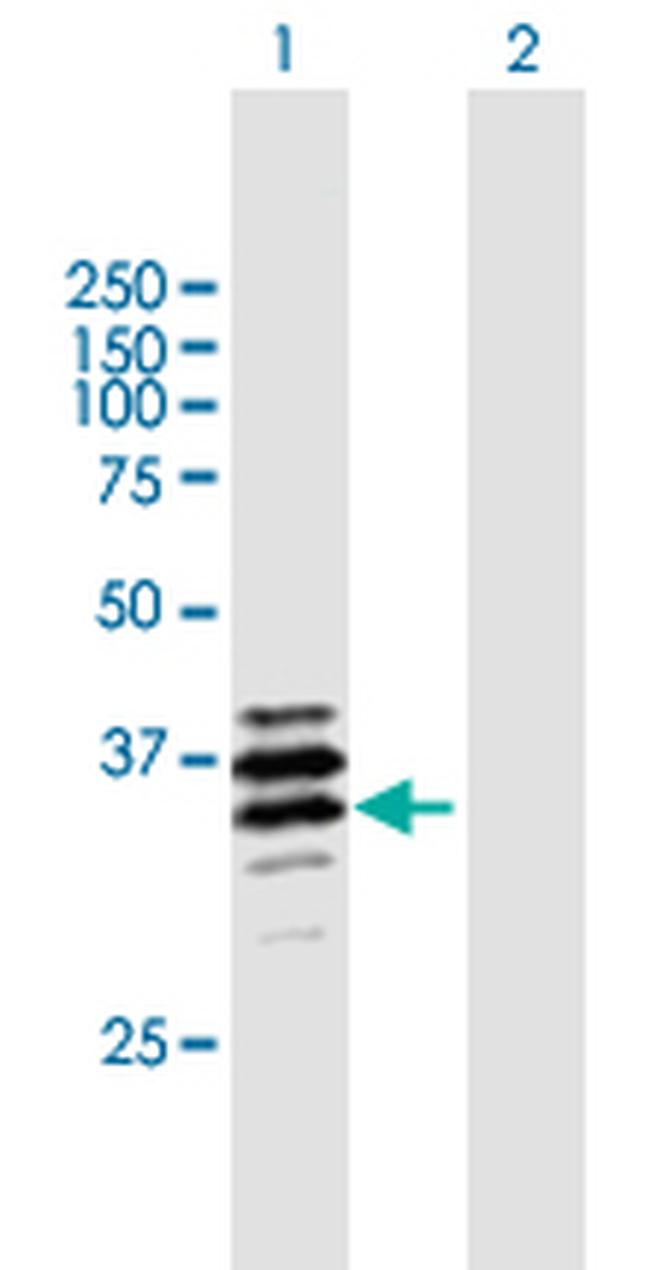 PPT2 Antibody in Western Blot (WB)