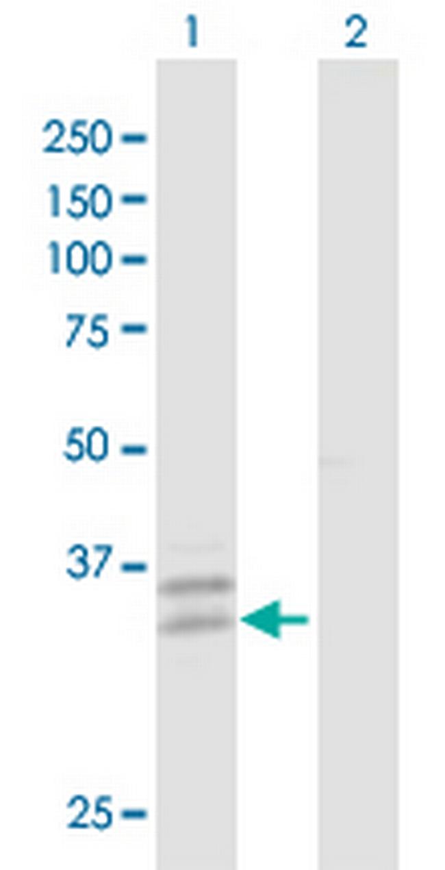 PPT2 Antibody in Western Blot (WB)