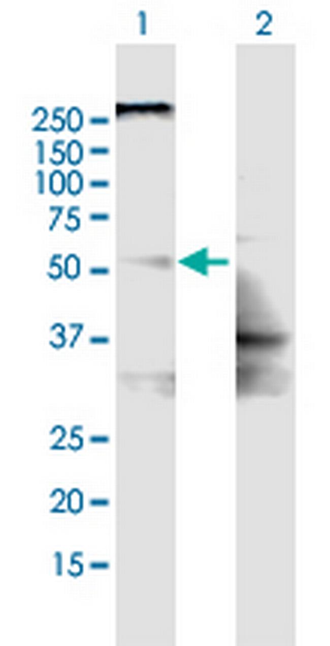 SLC22A8 Antibody in Western Blot (WB)