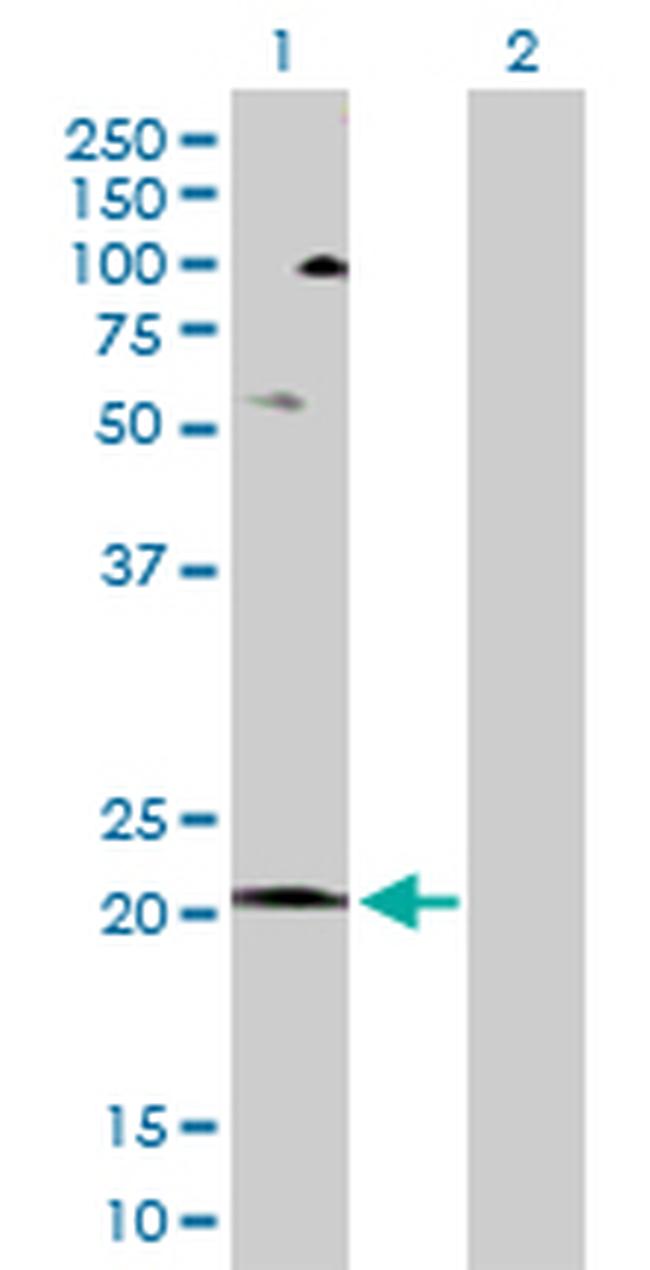 COX5A Antibody in Western Blot (WB)