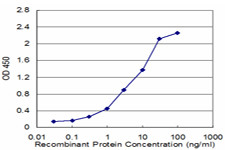 ZNF265 Antibody in ELISA (ELISA)