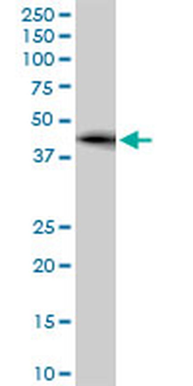 ZNF265 Antibody in Western Blot (WB)