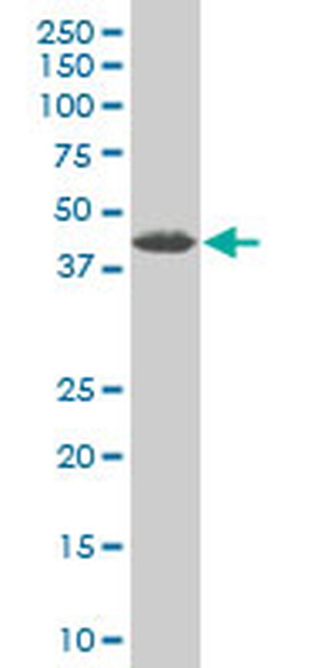 ZNF265 Antibody in Western Blot (WB)