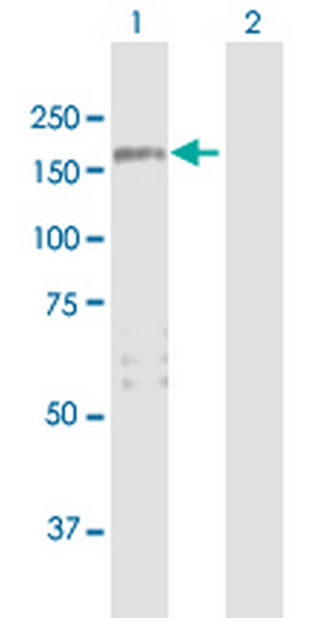 ARHGAP29 Antibody in Western Blot (WB)