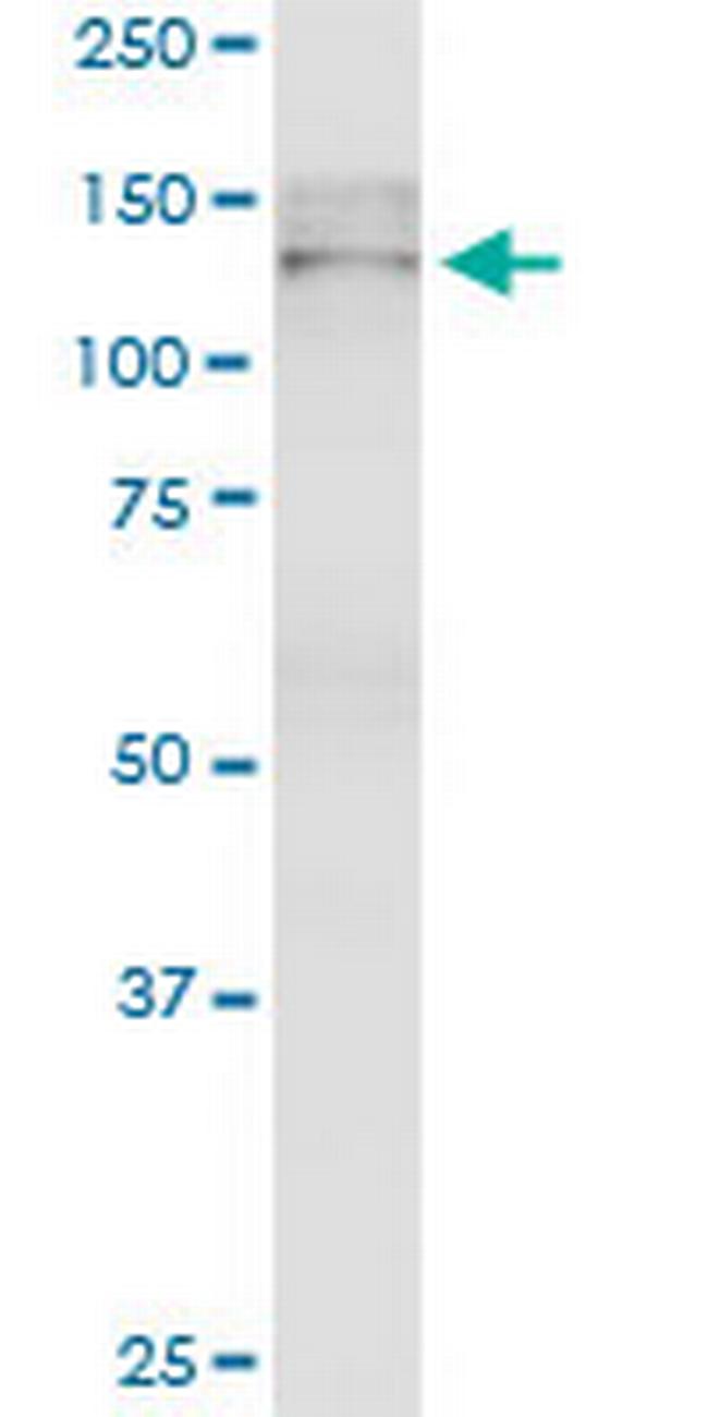 TJP2 Antibody in Western Blot (WB)