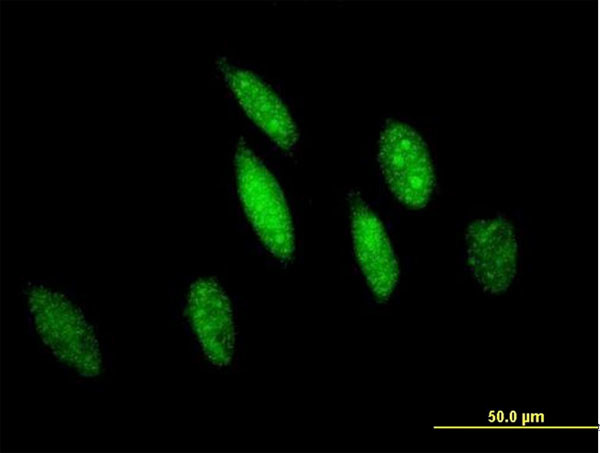 GSTO1 Antibody in Immunocytochemistry (ICC/IF)