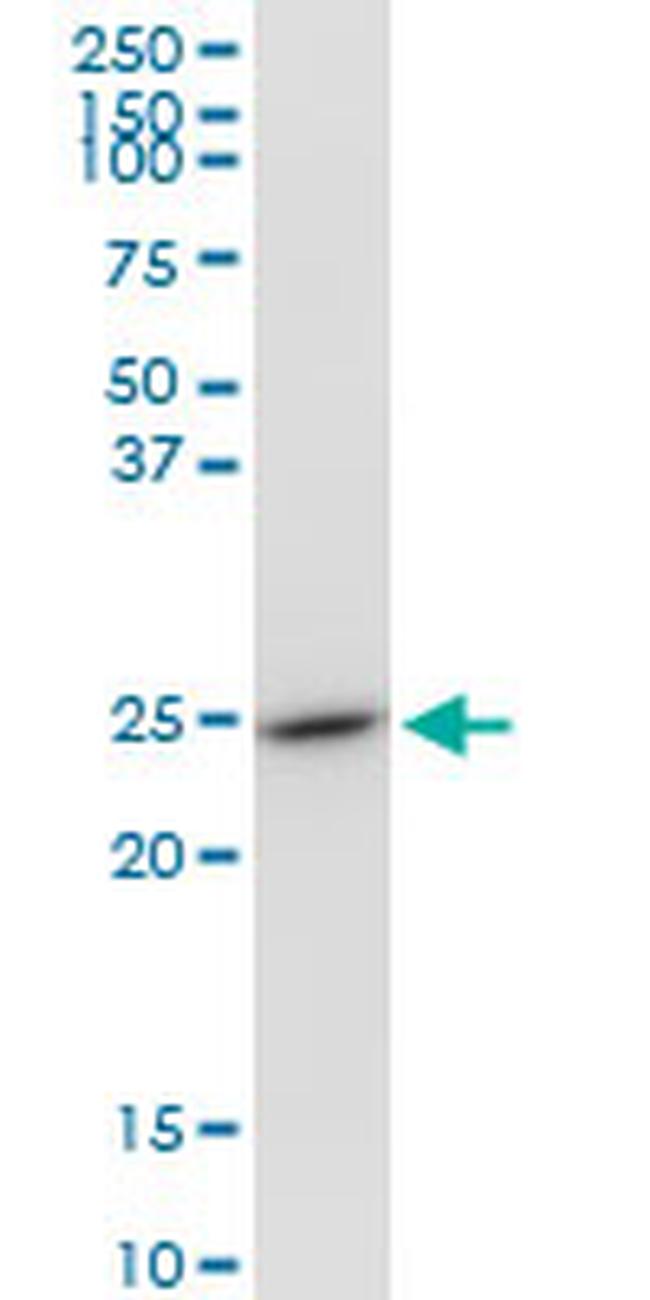 GSTO1 Antibody in Western Blot (WB)