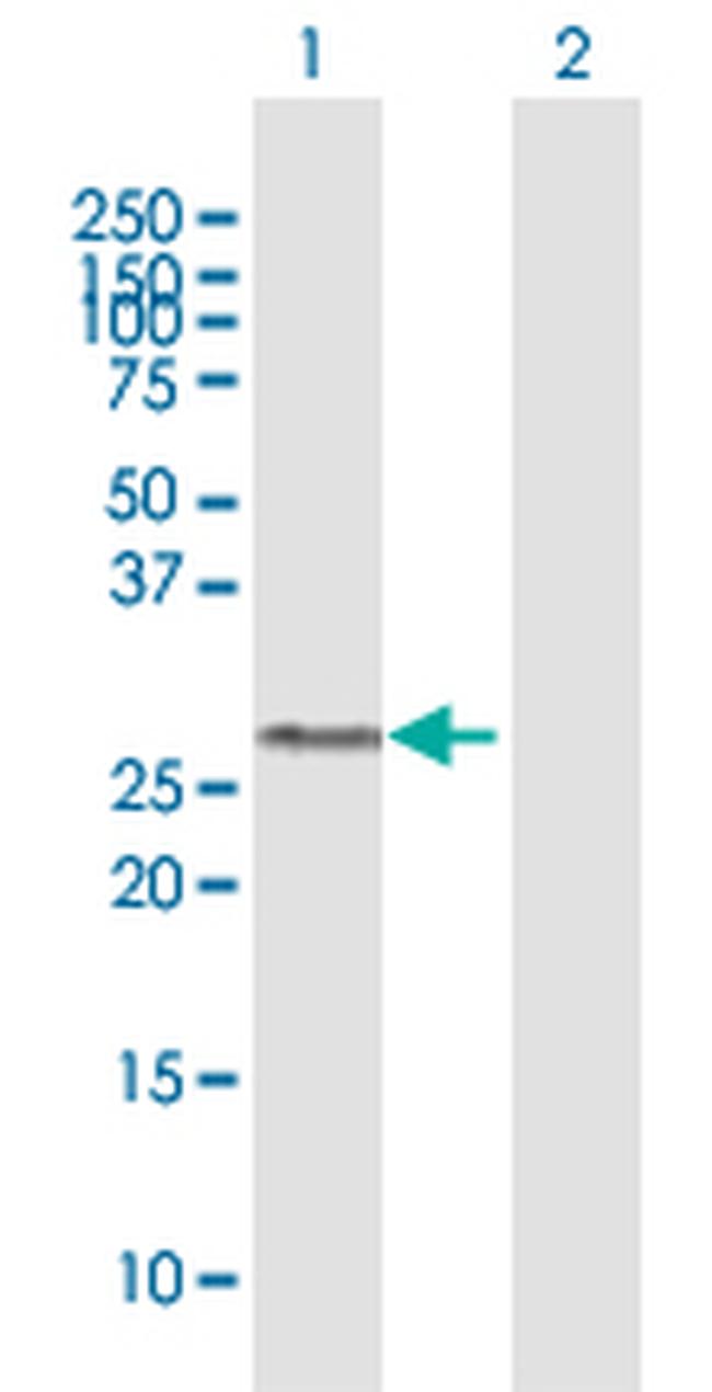 GSTO1 Antibody in Western Blot (WB)