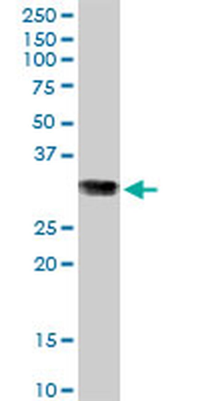 GSTO1 Antibody in Western Blot (WB)