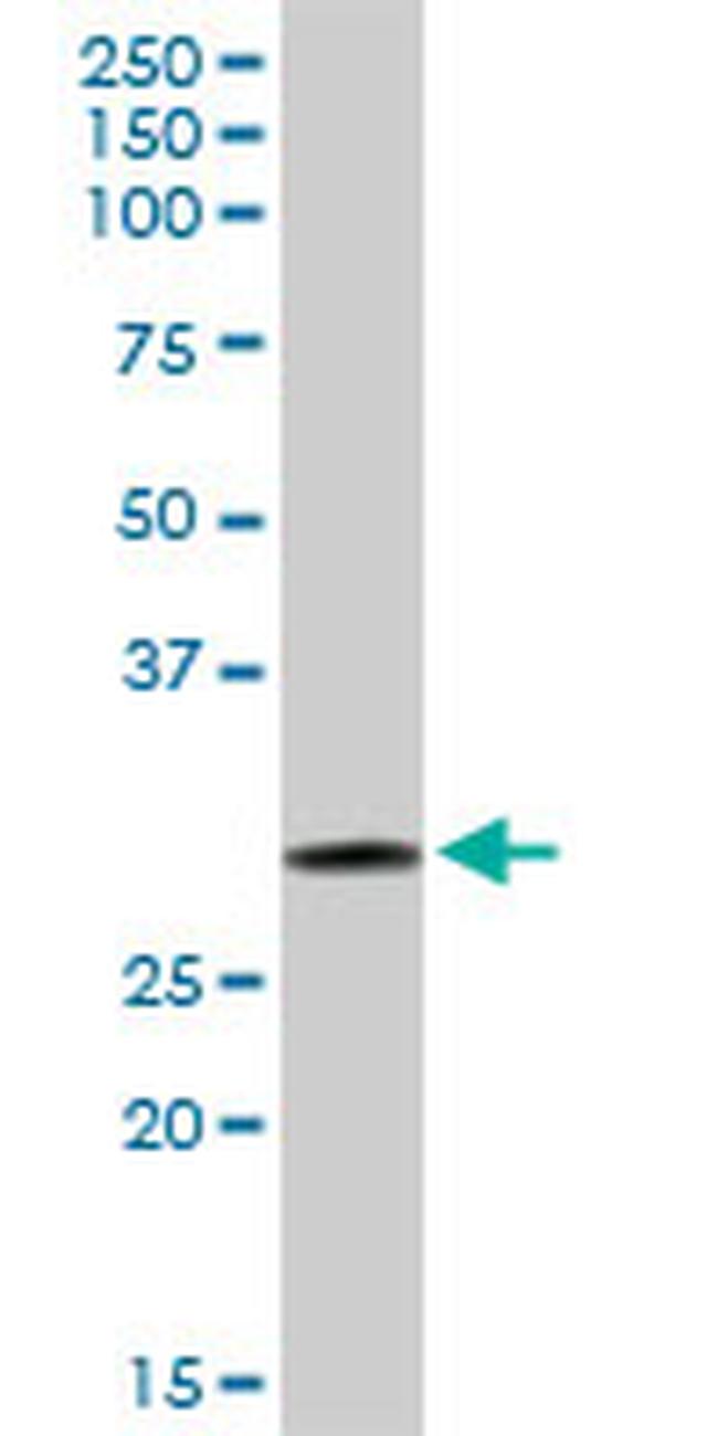 GSTO1 Antibody in Western Blot (WB)