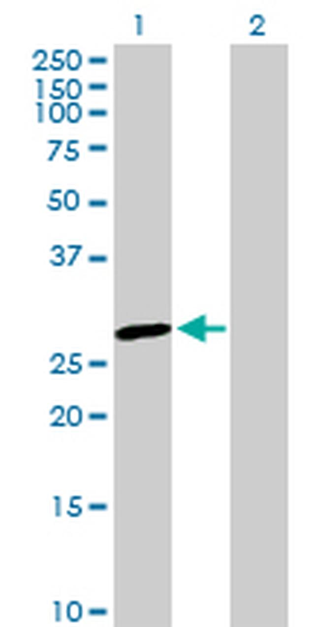 GSTO1 Antibody in Western Blot (WB)