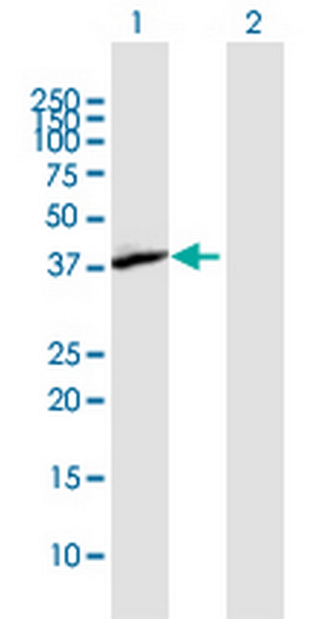 AIM2 Antibody in Western Blot (WB)