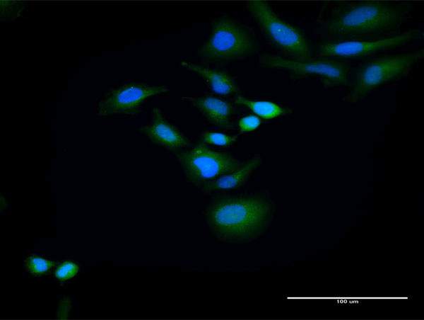 HOMER2 Antibody in Immunocytochemistry (ICC/IF)