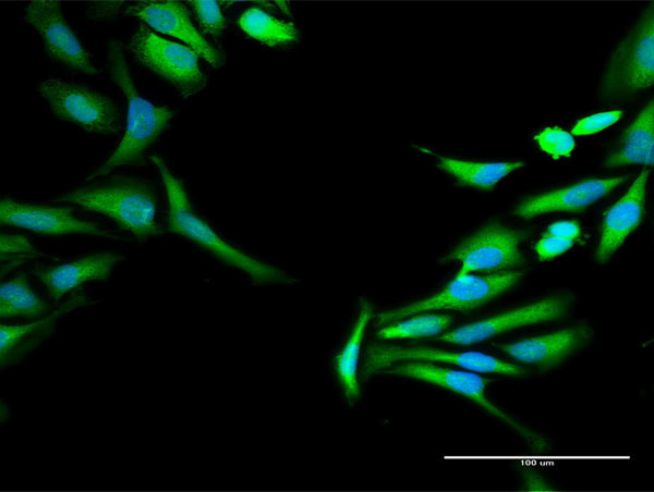 HOMER1 Antibody in Immunocytochemistry (ICC/IF)