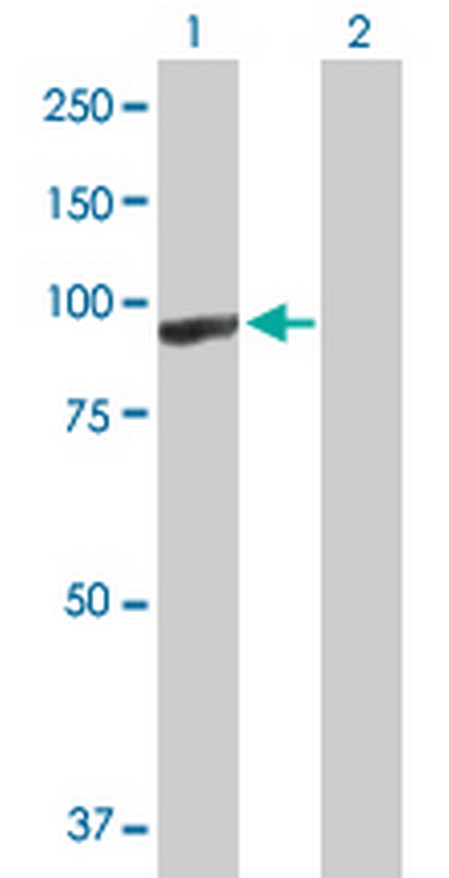 ARHGEF6 Antibody in Western Blot (WB)