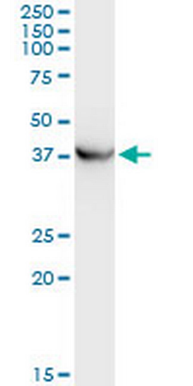 PRKCABP Antibody in Western Blot (WB)