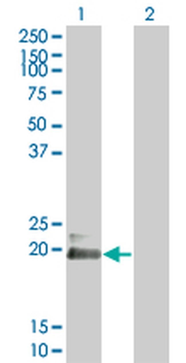 HAND2 Antibody in Western Blot (WB)