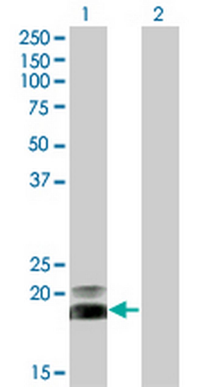 HAND2 Antibody in Western Blot (WB)